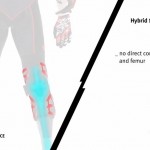 Dainese Hybrid Knee Brace